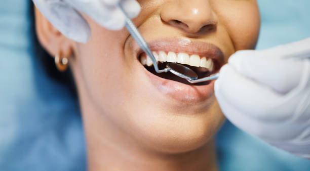 Best Weekend Emergency Dentist in Mirrormont, WA